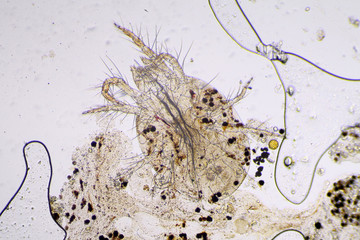 Spider mite under the microscope