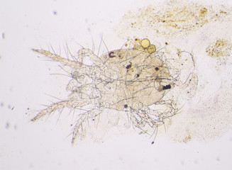 Spider mite under the microscope