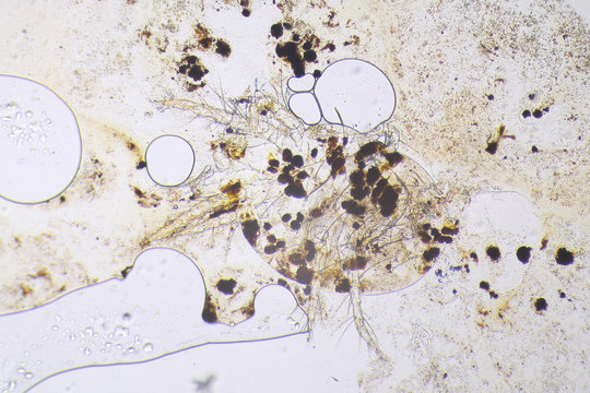 Spider mite under the microscope