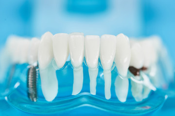 Fototapeta na wymiar close up of teeth model with dental roots in white teeth on blue