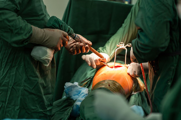 Hip replacement surgery in progress, open cavity with soft-tissue retractors and slide tool. Old...