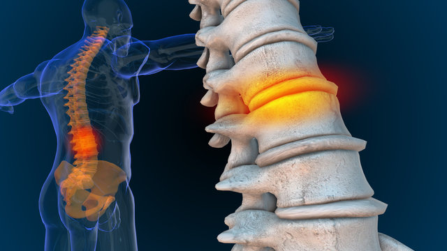 3d rendered illustration of  back and spine pain 3D illustration