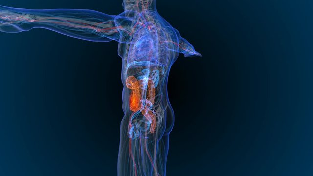 3d rendered illustration of  bowel cancer 3D illustration