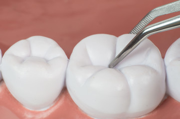 Fototapeta na wymiar teeth with dentist apparatus for extraction