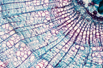 Cross section - Xylem is a type of tissue in vascular plants that transports water and some nutrients.