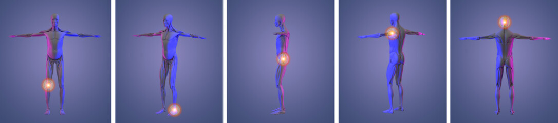 3d rendering illustration of pain muscle collection