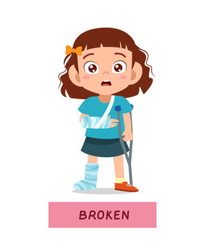 kid girl with fracture leg vector