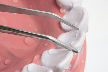 tooth extraction with dentist pint on White background