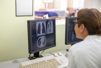 Obraz na płótnie Canvas Doctor looking at monitor with chest CT scan images