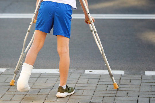 Childhood injuries. Young boy in orthopedic cast on crutches walking on the street near the road. Child with broken leg on crutches, ankle injury. Bone fracture and ankle fracture