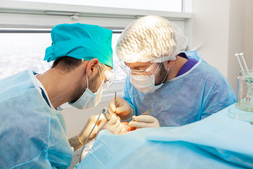 Baldness treatment. Hair transplant. Surgeons in the operating room carry out hair transplant surgery. Surgical technique that moves hair follicles from a part of the head.