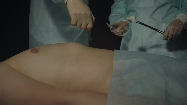 Surgeon shows the assistant where to make an incision on the patient s body during operation or procedure. Person lies on surgical table in hospital. Doctor with scalpel and forcep ready to start cut