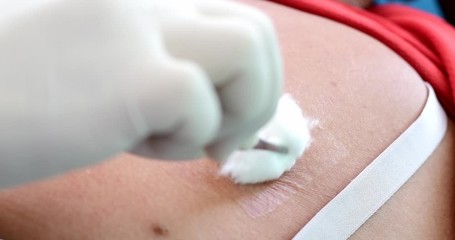 cleaning infected wound on  chest  