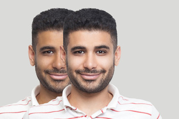 Closeup portrait of young brunette bearded man with different facial skin tone, darker and lighter,...