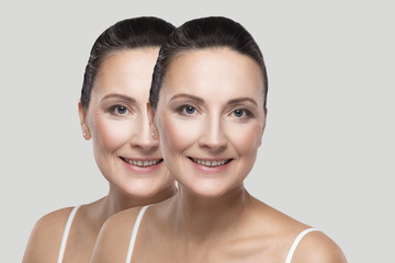 Before and after beauty skin wrinkles treatment procedure. Middle aged brunette woman looking, toothy smile. plastic surgery, cosmetic procedure concept. indoor studio shot, isolated, gray background