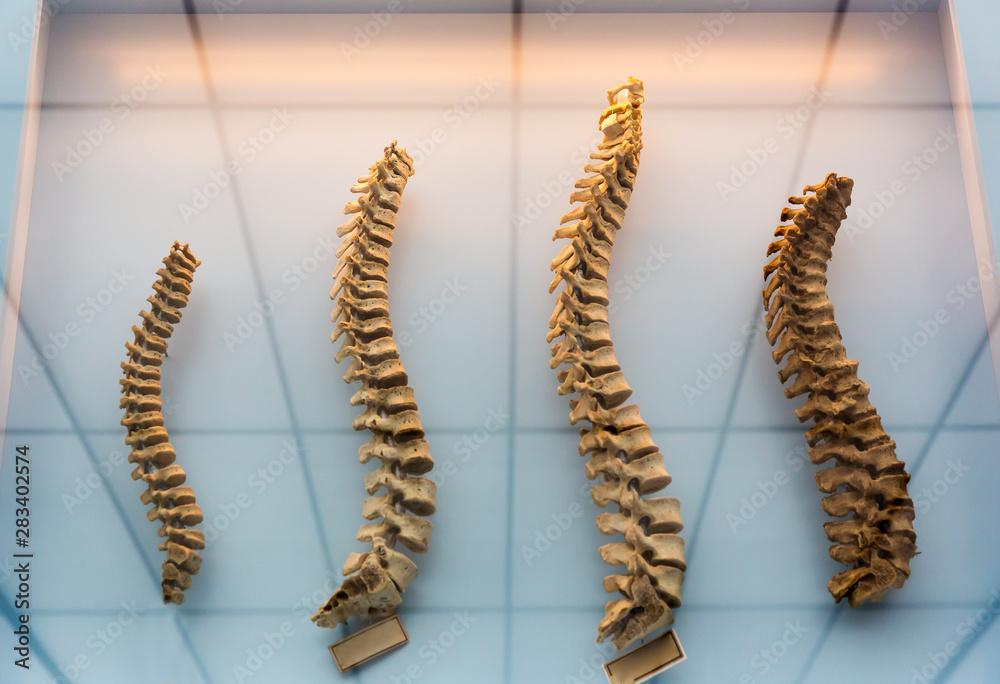 Wall mural model of a human spine, spinal columns