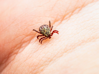 Encephalitis Virus or Lyme Borreliosis Disease Infectious Dermacentor Tick Arachnid Parasite Insect on Skin Macro