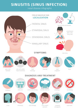 Nasal diseases. Sinusitis, sinus infection diagnosis and treatment medical infographic design