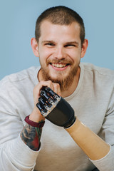 Young Man With Artificial hand is looking forward and smiling at the camera
