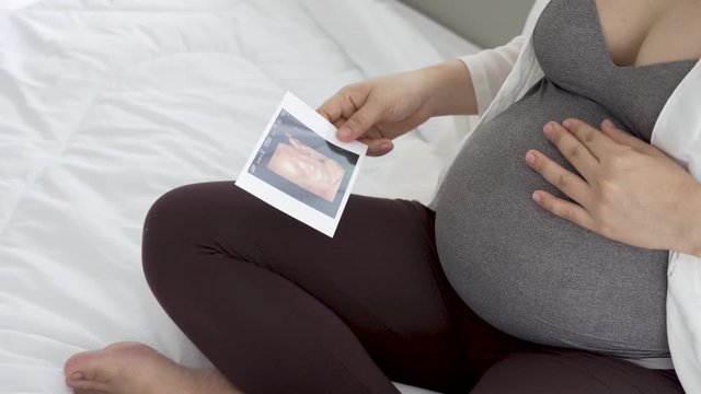 Pregnant women are viewing pictures of babies from ultrasound.
