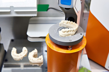 Plaster cast for manufacture of dentures