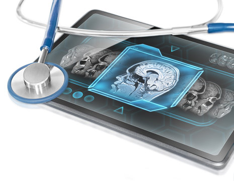 Medical tablet displaying human brain scan