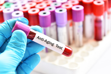 Fototapeta premium Test tube with blood sample for anti-aging test 