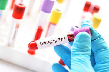 Test tube with blood sample for anti-aging test 