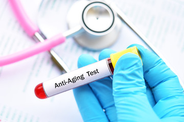 Test tube with blood sample for anti-aging test 