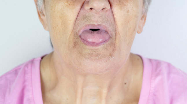 Toothless mouth. An elderly woman with no teeth. Old Granny with her mouth  open. Stock Photo | Adobe Stock