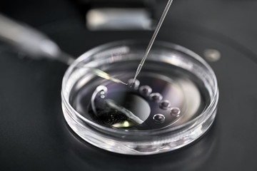 Process of in vitro fertilization in laboratory - obrazy, fototapety, plakaty