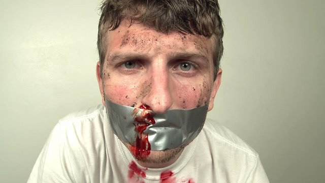 Male with blood on face and duct tape on mouth.