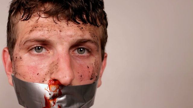 Man with bloody face and duct tape mouth