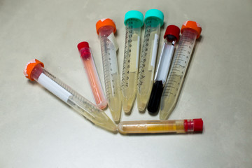 laboratory equipment pipette dropping sample into a test tube,abstract science background.