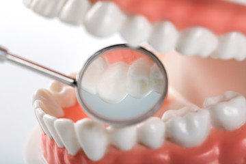 Fototapeta na wymiar oral hygiene - closeup of dental mirror inside the teeth model