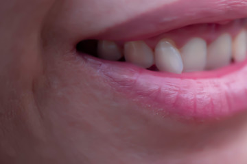 Obraz premium The front teeth can be seen while smiling.