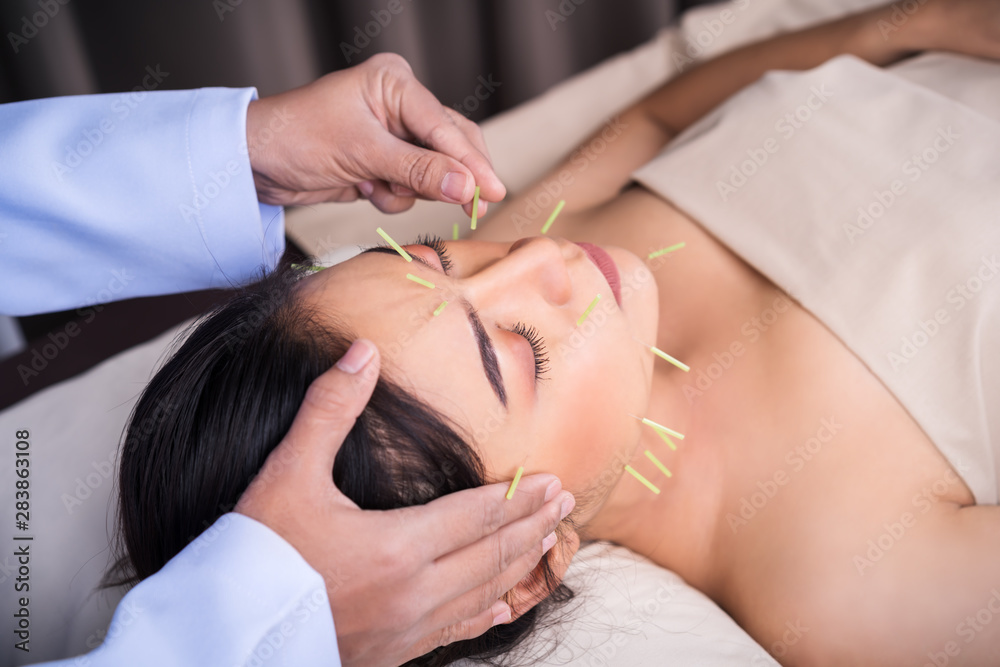 Sticker woman undergoing acupuncture treatment on face