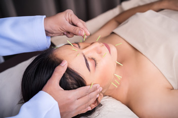 woman undergoing acupuncture treatment on face - obrazy, fototapety, plakaty