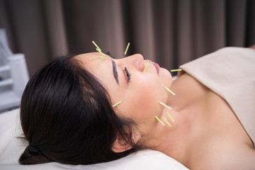 woman undergoing acupuncture treatment on face