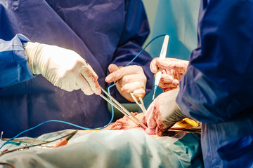 Surgical equipment used during the operation. Modern Operating Room