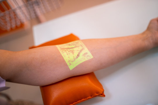 Vein Scanning. Patient Hand With Veins Mapping Close Up