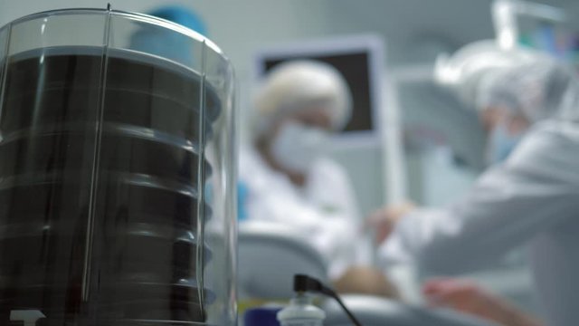 surgery with anesthesia, in modern a clinic dentist treats patient under narcosis video out of focus