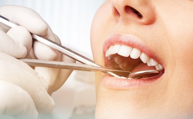 Odontology periodontal attractive teenager beautiful girl bleaching