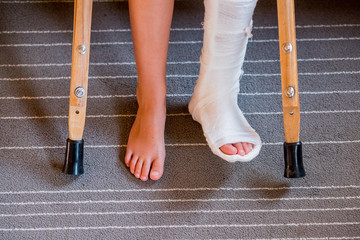 Broken leg in cast of unrecognizable little child.Young girl in orthopedic cast on crutches in...