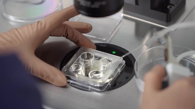 Process of in vitro fertilization in laboratory