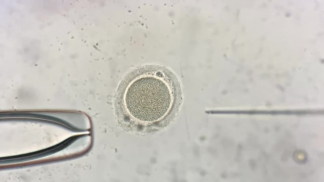 View through microscope at in vitro fertilization process