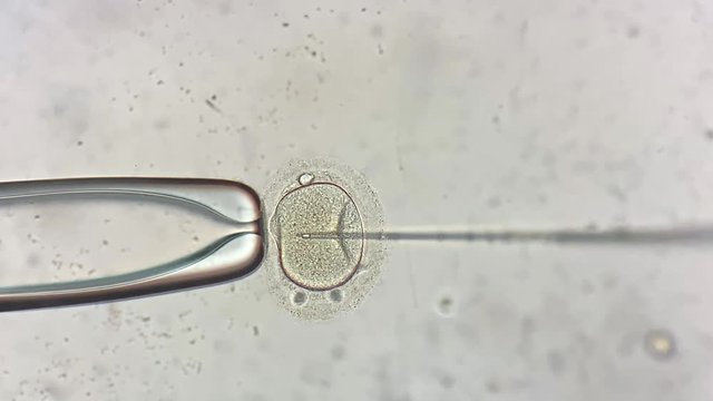 View through microscope at in vitro fertilization process