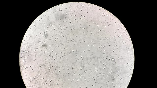 View at human sperm under microscope in lab