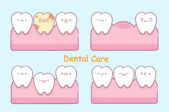 cartoon tooth with decay problem