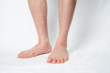 メンズ 除毛1週間後の脚 ムダ毛処理の面倒くささをイメージ